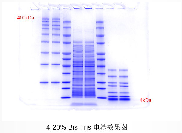 4-20% BT胶电泳效果图.png